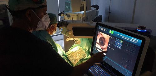 Quirónsalud Málaga incorpora el láser refractivo más avanzado y personalizado del mercado